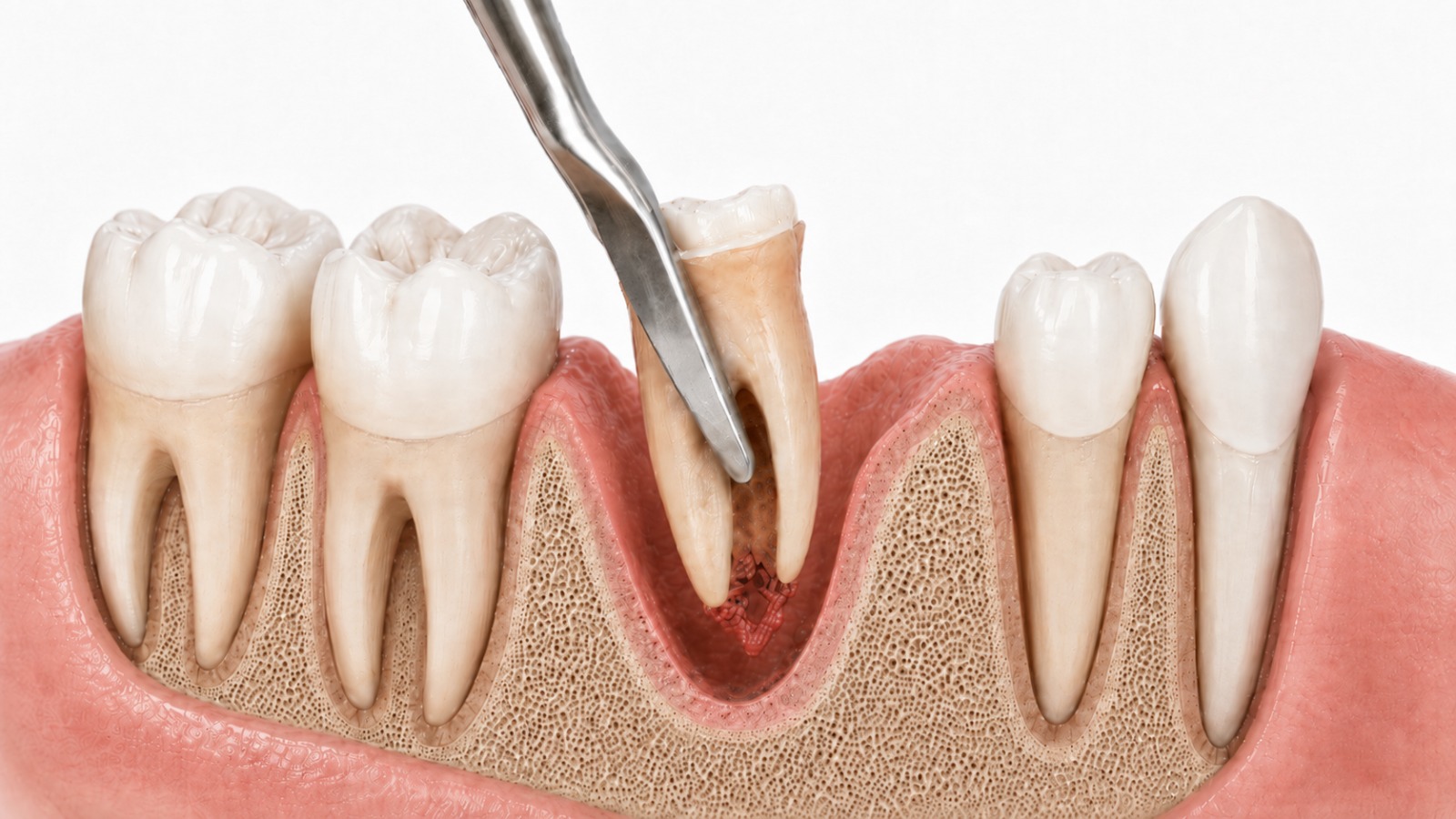 Oralchirurgie — chirurgische Eingriffe